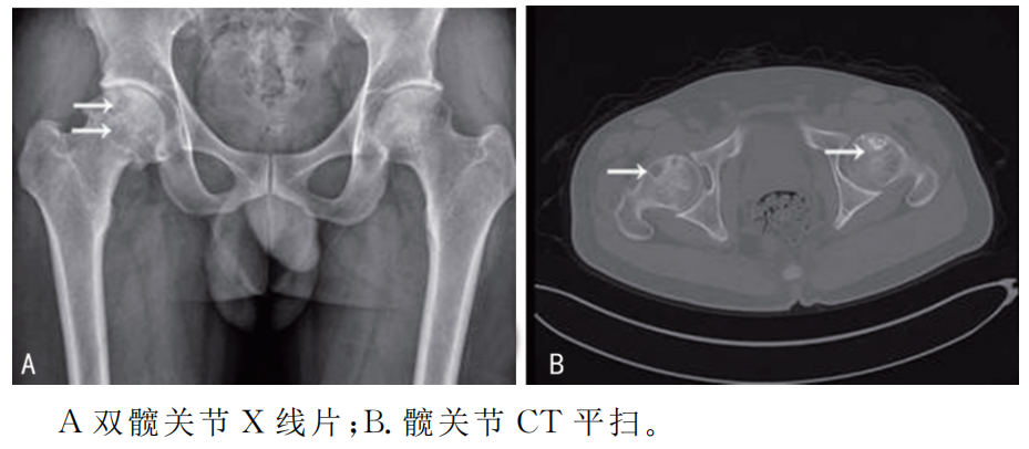 干細(xì)胞治療