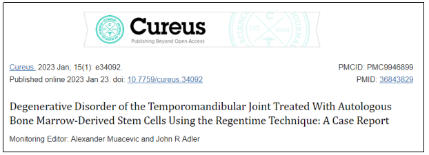 Cureus期刊最新報道：干細胞治療1例下頜關節(jié)退行性疾病，隨訪顯示完全康復